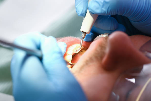 Best Broken or Cracked Tooth Emergency Dentist in Taneytown, MD